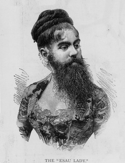 Annie Jones, known as the Esau Lady, 1893 by Unknown